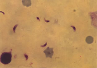 寄生虫图片1-肝吸虫              寄生虫图片-鸡球虫病